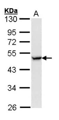 Western Blot: CCR8 Antibody [NBP2-15768] - Sample (30 ug of whole cell lysate)  A: Hela 10% SDS PAGE diluted at 1:1000 