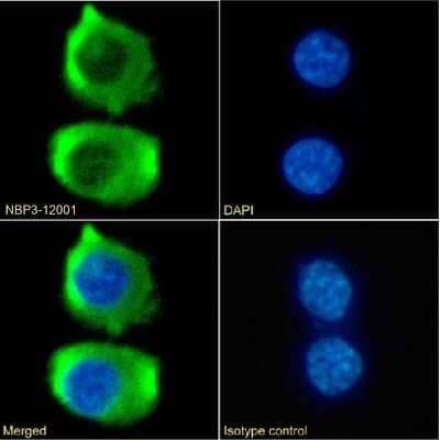 Immunocytochemistry/Immunofluorescence: CCR9 Antibody (9B1) - Chimeric [NBP3-12001] - Immunofluorescence analysis of paraformaldehyde fixed RAW264.7 cells on Shi-fix(TM) coverslips stained with the chimeric rabbit IgG version of 9B1 (NBP3-12001) at 10 ug/ml for 1h followed by Alexa Fluor(R) 488 secondary antibody (2 ug/ml), showing membrane staining. The nuclear stain is DAPI (blue). Panels show from left-right, top-bottom NBP3-12001, DAPI, merged channels and an isotype control. The isotype control was an unknown specificity antibody followed by staining with Alexa Fluor(R) 488 secondary antibody.