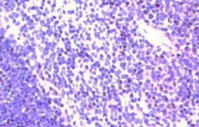 Immunohistochemistry-Paraffin: CCR9 Antibody [NB100-708] - Analysis using the Biotin conjugate of NB100-708. Staining of mouse spleen.