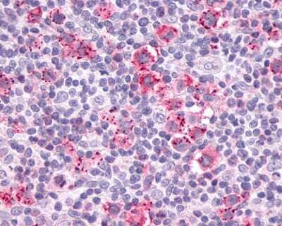 Immunohistochemistry-Paraffin: CCR9 Antibody [NLS961] - Analysis of anti-CCR9 antibody with human lymph node, Hodgkins lymphoma.