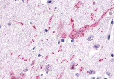 Immunohistochemistry-Paraffin: CCR9 Antibody [NLS961] - Brain Amygdala Neuron and Cell Processes
