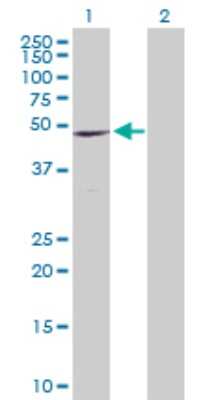 Western Blot: CCR9 Antibody [H00010803-D01P] - Analysis of CCR9 expression in transfected 293T cell line by CCR9 polyclonal antibody.Lane 1: CCR9 transfected lysate(42.00 KDa).Lane 2: Non-transfected lysate.
