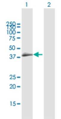 Western Blot: CCRL2/CRAM-A/B Antibody [H00009034-D01P] - Analysis of CCRL2 expression in transfected 293T cell line by CCRL2 polyclonal antibody.Lane 1: CCRL2 transfected lysate(39.5 KDa).Lane 2: Non-transfected lysate.
