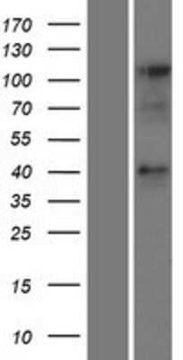 Western Blot: CCRL2 Overexpression Lysate (Adult Normal) [NBP2-09525] Left-Empty vector transfected control cell lysate (HEK293 cell lysate); Right -Over-expression Lysate for CCRL2.