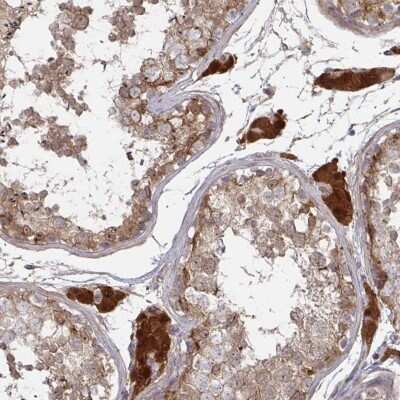 Immunohistochemistry-Paraffin CCS/SOD4 Antibody