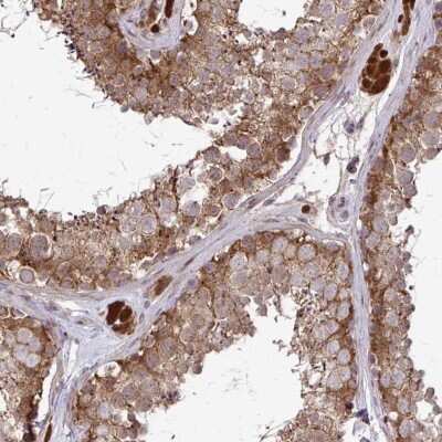 Immunohistochemistry-Paraffin: CCS/SOD4 Antibody [NBP2-58066] - Staining of human testis shows strong cytoplasmic positivity in Leydig cells.