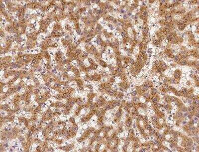 Immunohistochemistry-Paraffin: CCS/SOD4 Antibody [NBP3-12717] - Staining of human CCS in human liver with rabbit polyclonal antibody at 1:100 dilution.