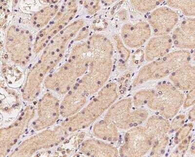 Immunohistochemistry-Paraffin: CCS/SOD4 Antibody [NBP3-12717] - Staining of human CCS in human kidney with rabbit polyclonal antibody at 1:100 dilution.