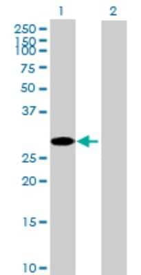 Western Blot: CCS/SOD4 Antibody [H00009973-B01P] - Analysis of CCS expression in transfected 293T cell line by CCS polyclonal antibody.  Lane1:CCS transfected lysate(30.14 KDa). Lane2:Non-transfected lysate.