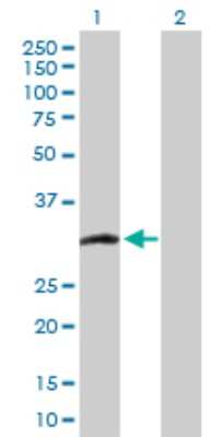 Western Blot: CCS/SOD4 Antibody [H00009973-D01P] - Analysis of CCS expression in transfected 293T cell line by CCS polyclonal antibody.Lane 1: CCS transfected lysate(29.00 KDa).Lane 2: Non-transfected lysate.