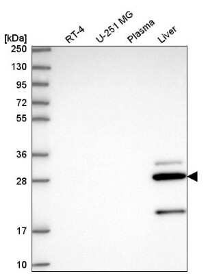 Western Blot CCS/SOD4 Antibody