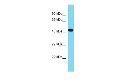 Western Blot CCSMST1 Antibody - BSA Free