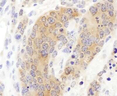 <b>Independent Antibodies Validation and Biological Strategies Validation.</b>Immunohistochemistry-Paraffin: CCT3 Antibody [NBP1-79040] - Section of mouse teratoma. Antibody: Affinity purified rabbit anti- CCT3 used at a dilution of 1:200 (1ug/ml). Detection: DAB. Counterstain: hematoxylin (blue).