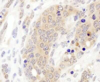 <b>Independent Antibodies Validation and Biological Strategies Validation.</b>Immunohistochemistry-Paraffin: CCT3 Antibody [NBP1-79041] - Sample: FFPE section of mouse teratoma. Antibody: Affinity purified rabbit anti- CCT3 used at a dilution of 1:200 (1ug/ml). Detection: DAB. Counterstain: hematoxylin (blue).