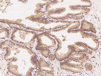 Immunohistochemistry-Paraffin: CCT3 Antibody [NBP2-99267] - Immunochemical staining of human CCT3 in human prostate with rabbit polyclonal antibody at 1:300 dilution, formalin-fixed paraffin embedded sections.