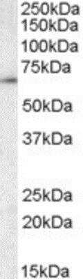 Western Blot: CCT3 Antibody [NBP1-51949] - Analysis of CCT3 in Mouse Testis lysate (35ug protein in RIPA buffer) using this antibody at 0.01 ug/ml. Primary incubation was 1 hour. Detected by chemiluminescence.