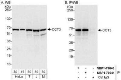 Western Blot: CCT3 Antibody [NBP1-79040] - Whole cell lysate from HeLa (15 and 50 mcg for WB; 1 mg for IP, 20% of IP loaded), 293T (T; 50 mcg), Jurkat (J; 50 mcg) and mouse NIH3T3 (M; 50 mcg) cells.  Antibodies: Affinity purified rabbit anti-CCT3 antibody  used for WB at 0.04 mcg/ml (A) and 0.4 mcg/ml (B) and used for IP at 6 mcg/mg lysate.  CCT3 was also immunoprecipitated by rabbit anti-CCT3 antibody NBP1-79041 which recognizes a downstream epitope