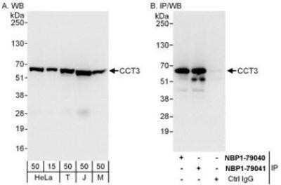 Western Blot: CCT3 Antibody [NBP1-79041] - Whole cell lysate from HeLa (15 and 50 mcg for WB; 1 mg for IP, 20% of IP loaded), 293T (T; 50 mcg), Jurkat (J; 50 mcg) and mouse NIH3T3 (M; 50 mcg) cells.  Antibodies: Affinity purified rabbit anti-CCT3 antibody used for WB at 0.04 mcg/ml (A) and 0.4 mcg/ml (B) and used for IP at 6 mcg/mg lysate.  CCT3 was also immunoprecipitated by rabbit anti-CCT3 antibody NBP1-79040 which recognizes an upstream epitope.