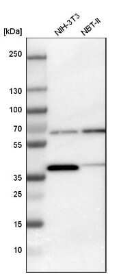 Western Blot: CCT3 Antibody [NBP1-86562] - Analysis in mouse cell line NIH-3T3 and rat cell line NBT-II.