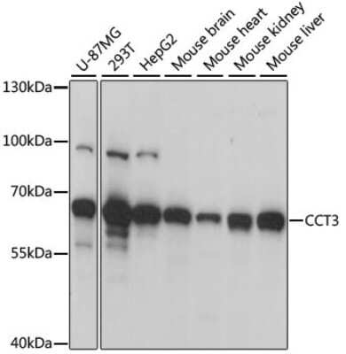 Western Blot: CCT3 Antibody [NBP2-92903] - Analysis of extracts of various cell lines, using CCT3 at 1:1000 dilution.Secondary antibody: HRP Goat Anti-Rabbit IgG (H+L) at 1:10000 dilution.Lysates/proteins: 25ug per lane.Blocking buffer: 3% nonfat dry milk in TBST.Detection: ECL Basic Kit .Exposure time: 5s.