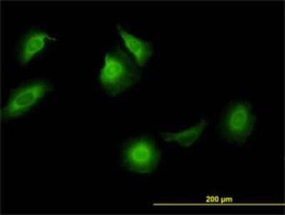 Immunocytochemistry/Immunofluorescence: CCT5 Antibody (4E5-4B1) [H00022948-M01] - Analysis of monoclonal antibody to CCT5 on HeLa cell. Antibody concentration 10 ug/ml.