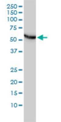 Western Blot: CCT5 Antibody (4E5-4B1) [H00022948-M01] - CCT5 monoclonal antibody (M01), clone 4E5-4B1 Analysis of CCT5 expression in Hela.