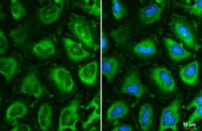 Immunocytochemistry/Immunofluorescence: CCT5 Antibody (639) [NBP2-43680] - CCT5 Antibody (639) detects CCT5 protein at centrosome and cytoplasm by immunofluorescent analysis. Sample: HeLa cells were fixed in ice-cold MeOH for 5 min. Green: CCT5 stained by CCT5 Antibody (639) diluted at 1:500. Blue: Hoechst 33342 staining. Scale bar= 10 um.