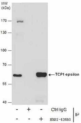 Immunoprecipitation: CCT5 Antibody (639) [NBP2-43680] - Analysis of TCP1 epsilon protein from 293T whole cell extracts using 5 ug of TCP1 epsilon antibody [639]. Western blot analysis was performed using TCP1 epsilon antibody [639]. EasyBlot anti-Rabbit IgG was used as a secondary reagent.