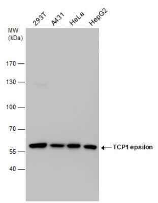 Western Blot: CCT5 Antibody (639) [NBP2-43680] - Analysis of various whole cell extracts (30 ug) were separated by 7.5 % SDS-PAGE, and blotted with TCP1 epsilon antibody diluted by 1:1000.