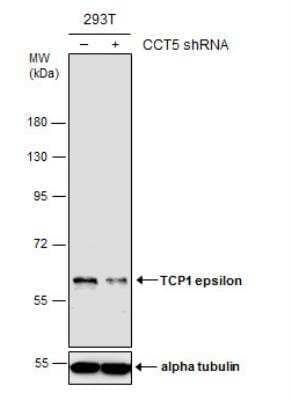 <b>Genetic Strategies Validation. </b>Western Blot: CCT5 Antibody (639) [NBP2-43680] - Non-transfected (-) and transfected (+) 293T whole cell extracts (30 ug) were separated by 7.5% SDS-PAGE, and the membrane was blotted with TCP1 epsilon antibody [639].