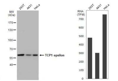 Western Blot: CCT5 Antibody (639) [NBP2-43680] - Various whole cell extracts (30 ug) were separated by 7.5% SDS-PAGE, and the membrane was blotted with CCT5 Antibody (639) diluted at 1:1000. HRP-conjugated anti-mouse IgG antibody was used to detect the primary antibody.