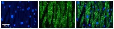 Immunohistochemistry: CCT5 Antibody [NBP1-56769] - Formalin Fixed Paraffin Embedded Tissue: Human heart Tissue Observed Staining: Cytoplasmic Primary Antibody Concentration: 1:100 Other Working Concentrations: N/A Secondary Antibody: Donkey anti-Rabbit-Cy3 Secondary Antibody Concentration: 1:200 Magnification: 20X Exposure Time: 0.5 - 2.0 sec