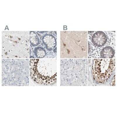 <b>Independent Antibodies Validation. </b>Immunohistochemistry-Paraffin: CCT5 Antibody [NBP1-83042] - Staining of human cerebral cortex, colon, liver and testis using Anti-CCT5 antibody NBP1-83042 (A) shows similar protein distribution across tissues to independent antibody NBP1-83043 (B).