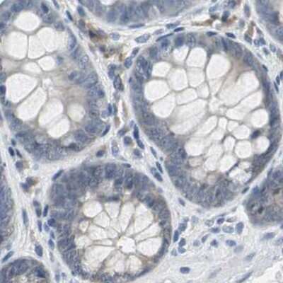 Immunohistochemistry-Paraffin: CCT5 Antibody [NBP1-83042] - Staining of human colon.