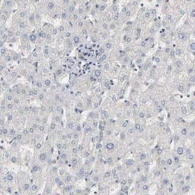 Immunohistochemistry-Paraffin: CCT5 Antibody [NBP1-83043] - Staining of human liver shows low expression as expected.