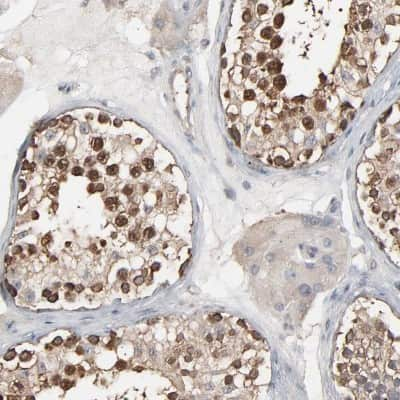 Immunohistochemistry-Paraffin: CCT5 Antibody [NBP1-83043] - Staining of human testis shows high expression.