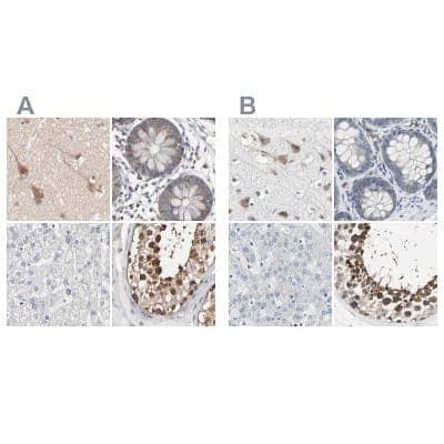 <b>Independent Antibodies Validation. </b>Immunohistochemistry-Paraffin: CCT5 Antibody [NBP1-83043] - Staining of human cerebral cortex, colon, liver and testis using Anti-CCT5 antibody NBP1-83043 (A) shows similar protein distribution across tissues to independent antibody NBP1-83042 (B).