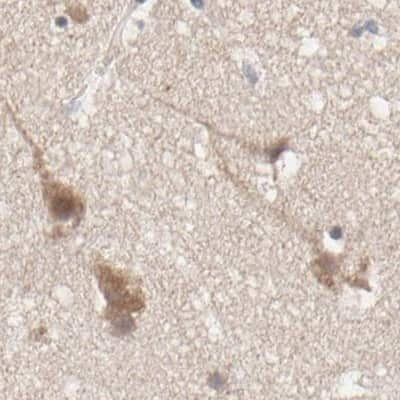 <b>Independent Antibodies Validation. </b>Immunohistochemistry-Paraffin: CCT5 Antibody [NBP1-83043] - Staining of human cerebral cortex.