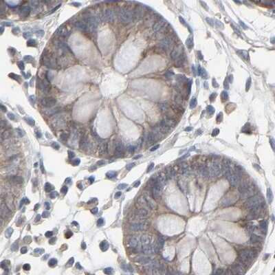 Immunohistochemistry-Paraffin: CCT5 Antibody [NBP1-83043] - Staining of human colon.