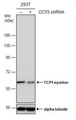 Western Blot: CCT5 Antibody [NBP1-31337] - Non-transfected (-) and transfected (+) 293T whole cell extracts (30 ug) were separated by 7.5% SDS-PAGE, and the membrane was blotted with TCP1 epsilon antibody [N1N3].