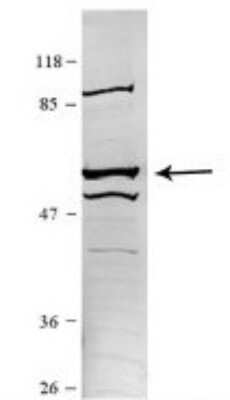 Western Blot: CCT5 Antibody [NBP1-56769] - Sample Type: HEK 293 (10ug) Primary Dilution: 1:1000 Secondary Antibody: conjugated goat anti-rabbit Secondary Dilution: 1:10,000 Image Submitted By: Amy Gray Brigham Young University.