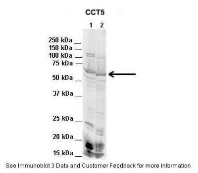 Western Blot: CCT5 Antibody [NBP1-56769] - Lanes: 1. Mouse WT brain extract (80 ug) 2. Rat brain extract (80 ug) Primary, Antibody Dilution: 2 ug/ml Secondary Antibody: IRDye 800CW goat anti-rabbit from Li-COR Bioscience Secondary, Antibody Dilution: 1 : 20,000 Gene name: CCT5.