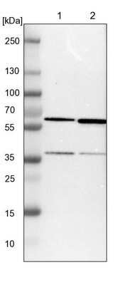 Western Blot: CCT5 Antibody [NBP1-83042] - Lane 1: NIH-3T3 cell lysate (Mouse embryonic fibroblast cells). Lane 2: NBT-II cell lysate (Rat Wistar bladder tumor cells).