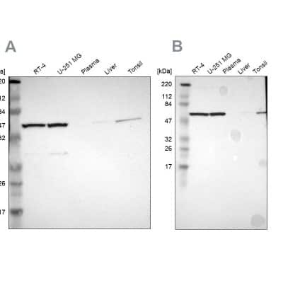 <b>Independent Antibodies Validation and Orthogonal Strategies Validation.</b>Western Blot: CCT5 Antibody [NBP1-83042] - Analysis using Anti-CCT5 antibody NBP1-83042 (A) shows similar pattern to independent antibody NBP1-83043 (B).