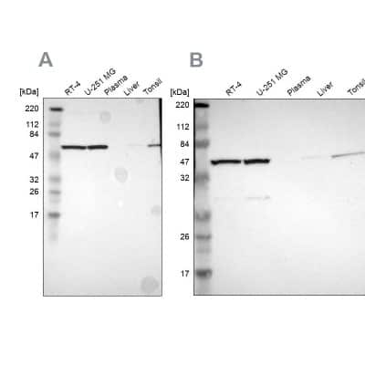 Western Blot: CCT5 Antibody [NBP1-83043] - Analysis using Anti-CCT5 antibody NBP1-83043 (A) shows similar pattern to independent antibody NBP1-83042 (B).