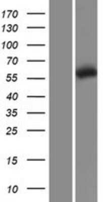 Western Blot CCT5 Overexpression Lysate