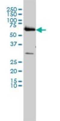 Western Blot: CCT6B Antibody (1A4) [H00010693-M01] - CCT6B monoclonal antibody (M01), clone 1A4 Analysis of CCT6B expression in HL-60.