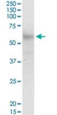 Western Blot: CCT6B Antibody [H00010693-B01P] - Analysis of CCT6B expression in human spleen.