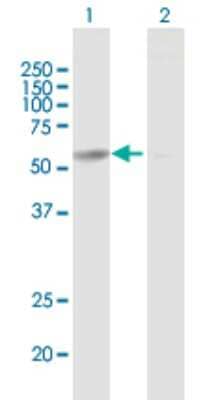 Western Blot: CCT6B Antibody [H00010693-B01P] - Analysis of CCT6B expression in transfected 293T cell line by CCT6B polyclonal antibody.  Lane 1: CCT6B transfected lysate(58.3 KDa). Lane 2: Non-transfected lysate.