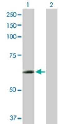 Western Blot: CCT6B Antibody [H00010693-D01P] - Analysis of CCT6B expression in transfected 293T cell line by CCT6B polyclonal antibody.Lane 1: CCT6B transfected lysate(57.80 KDa).Lane 2: Non-transfected lysate.